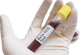 Image: Pregnancy HCG Serum - A medical test to detect human chorionic gonadotropin (HCG) levels in the blood, confirming pregnancy