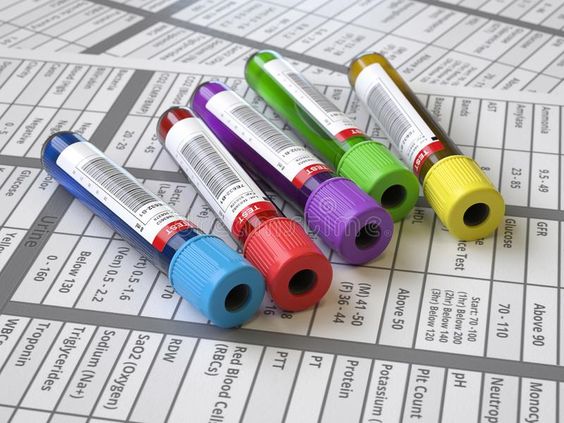Image: Vacuum Blood Collection Tubes - Essential medical equipment for efficient and hygienic blood sample collection